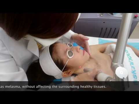 How to Avail Best Medical Face treatments Las Vegas – RevLite Laser Experience Comment